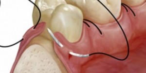 Cirugía oral y maxilofacial
